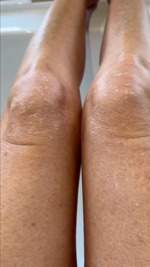 Kenna O